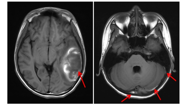 携手破难题 | 老虎机app
放射影像科与儿科精准诊断疑难病例